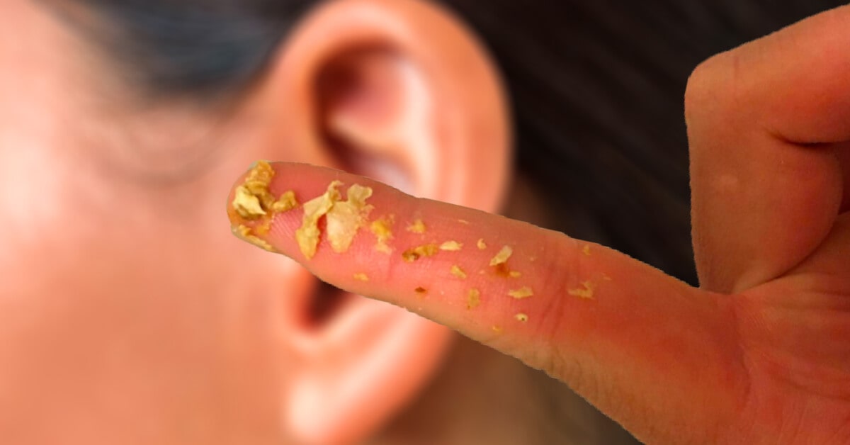 Dirty Ear